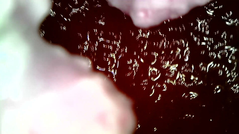 Nicoletta Embassi: Medical Endoscope Oral Exam: Gummy Chewing, Extreme Teeth &amp; Tongue Macro