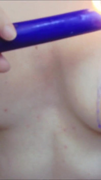 Cera caliente en los pezones