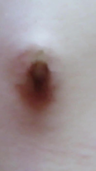 Mesmerizing Belly Button