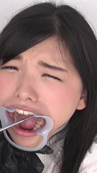 [teeth Observation] Natural Teeth but Potential Cavities Found!! Beauty Winces When Her Teeth Are Tapped - Suzu Shiratori