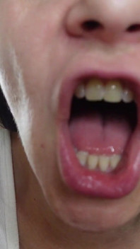 Ti masturba la faccia