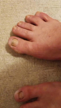 Footers