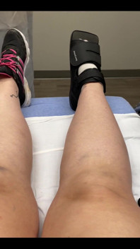 Welp, I messed up my foot