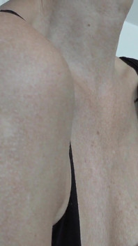 Scars on My Upper Arm, Lady Victoria Valente