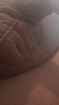 Penis