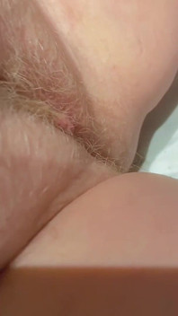 Hairy Labia