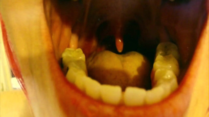 Quinn brooks: My Throat