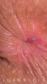 What if We Take High End Close up Camera and Shot 18 Years Old Girl Butthole Close up?