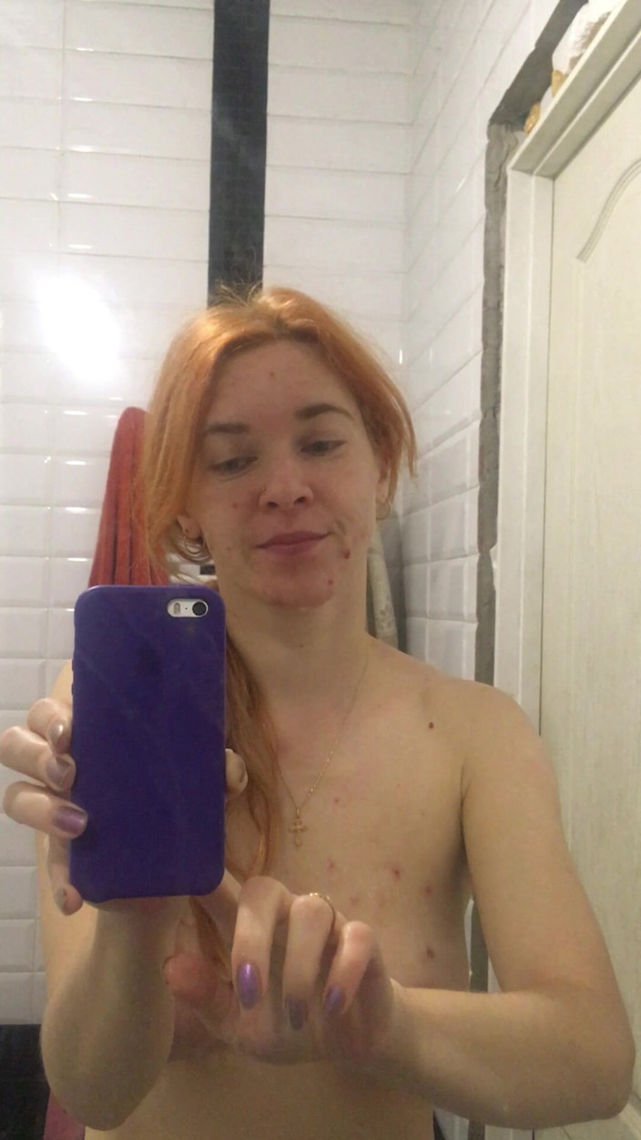 Risky Hairy Couple: 내 아침 셀카 이빨이 벌거벗은 칫솔질