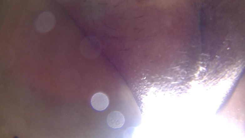 Florance Wimps: Subaquática