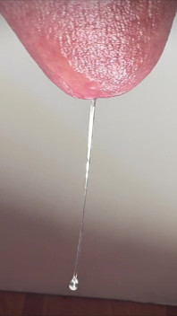Penis Tropft