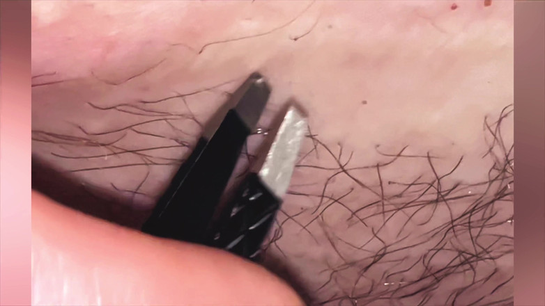 SatisfyingDillyDally: Щипаю себя