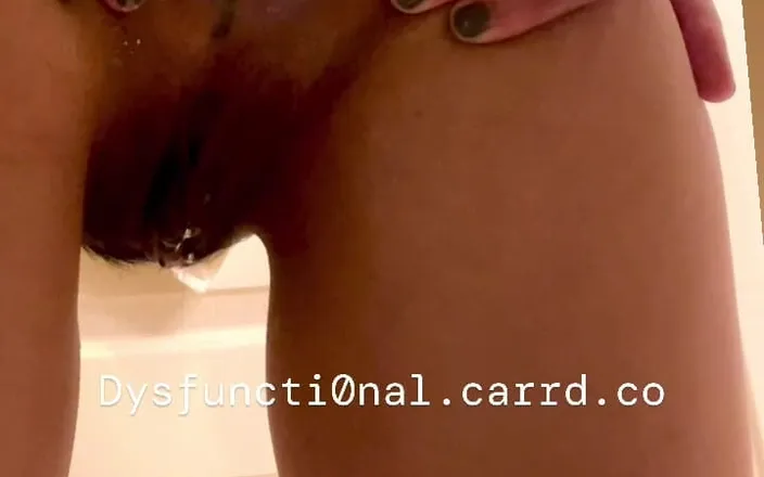 Dysfuncti0nal_s: Marshmallow Anal Fisting Ftm 1