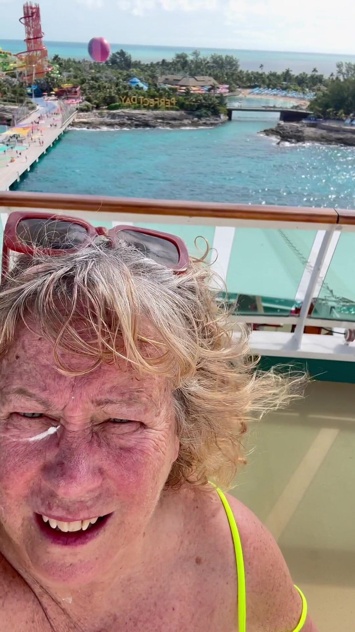 Big Ass 4 U: 모든 마지막 주근깨에 선스크린 넣기