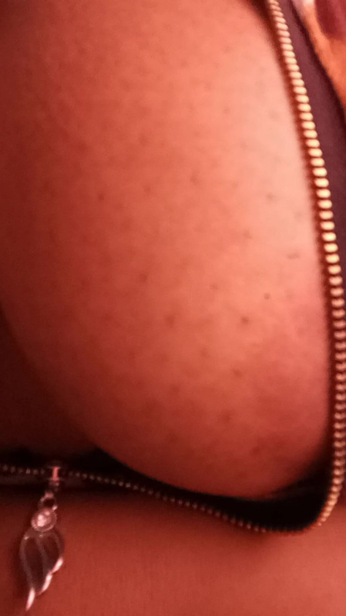 Putelgspot: Nejhezčí prsa, která kdy uvidíte