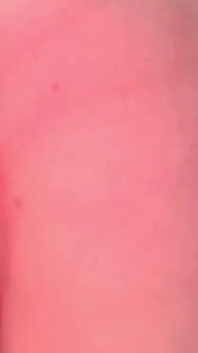 Przerwa