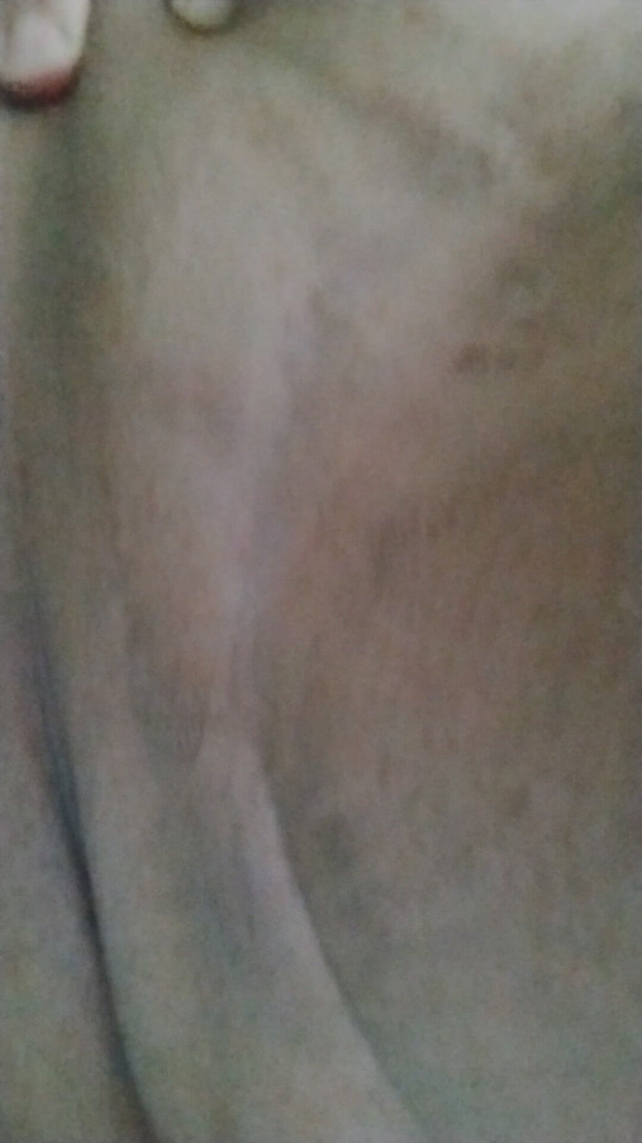 JG Risk: 2026-8-3 变性表演