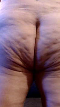 Cellulite-pressen
