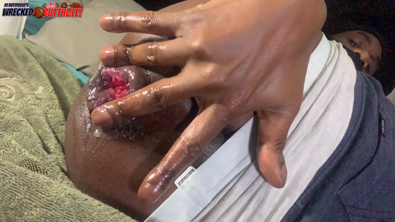 Ass Monkey: Digitación anal - twink negro destruido culo en cámara lenta (pero no...