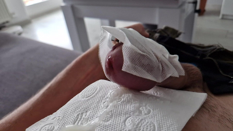 Lysyosiem: Với một đồ chơi