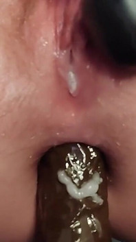 肛门收缩