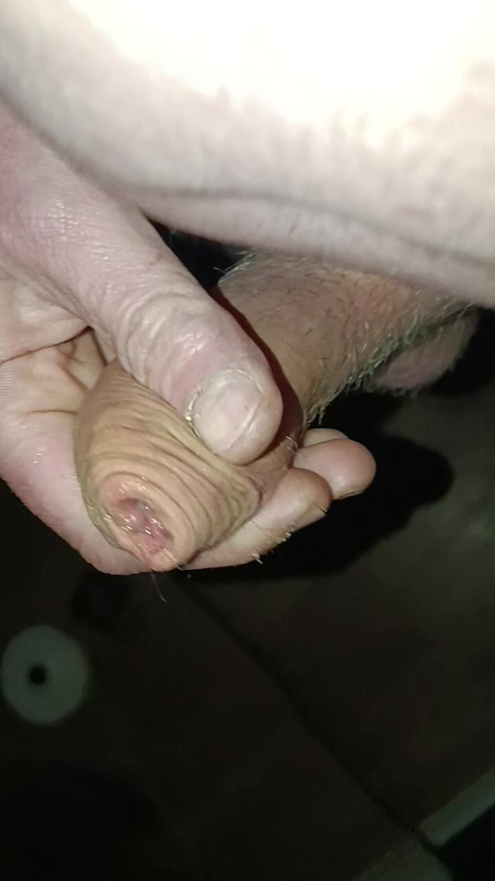 Nackt: Alles Mit Dir