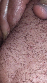 Anal Masturbation