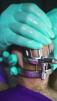 Sadistic Nurse 6: Sounding in Chastity