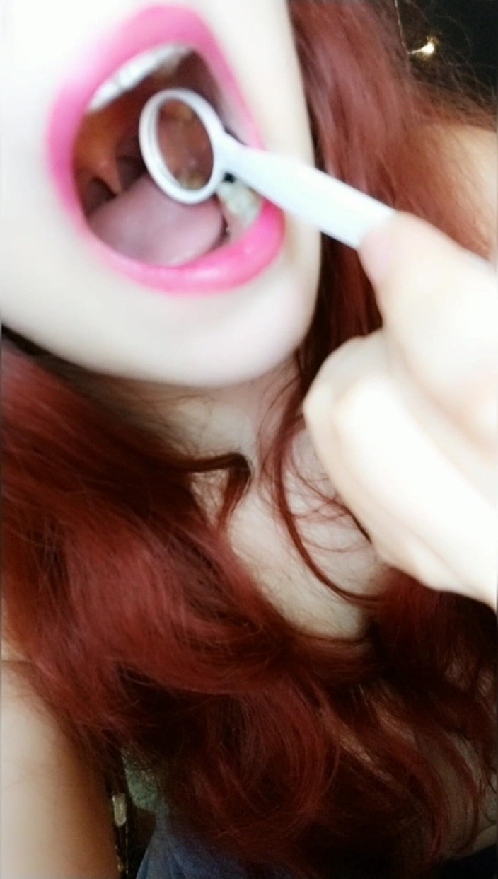 Scarlet Vixen: Pemeriksaan Cermin Gigi