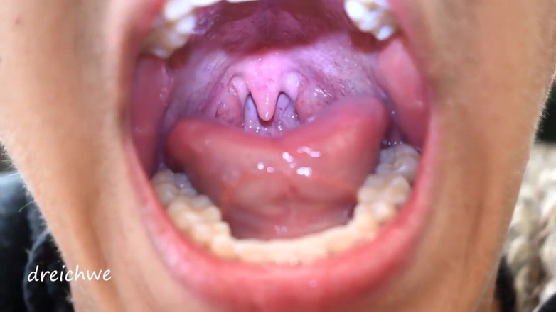 Dreichwe: Uvula fetish mouth