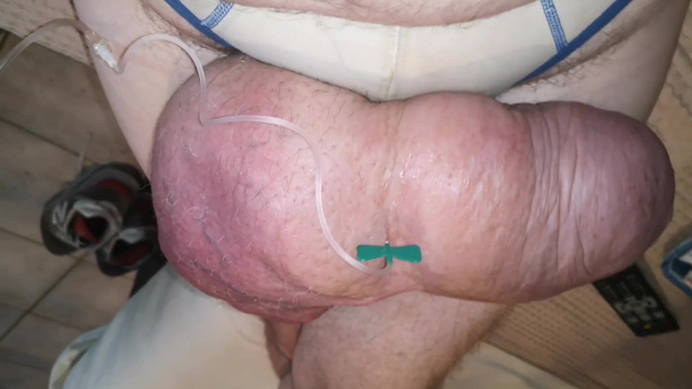 Monster_Meat_: Llenarse de nuevo con glucosa después de bombear