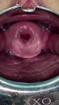 Glass Dildo Cervix Penetration