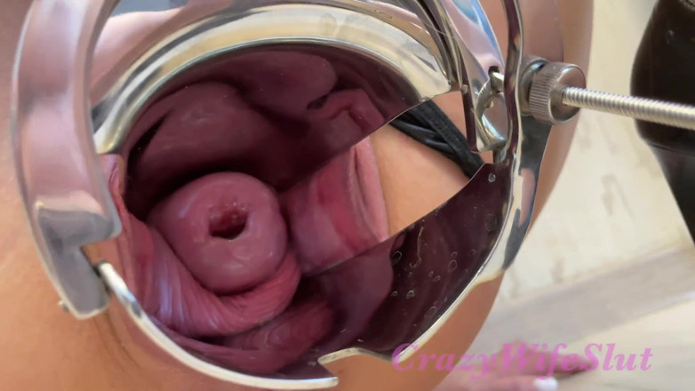 Crazywifeslut: Crazywifeslut con speculum enorme gioca con fisting e stretching