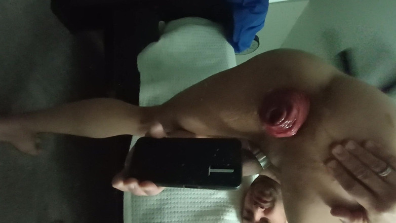 Brandon Lee: 水上运动和脱垂