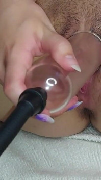 Alongamento anal! e Vagina!