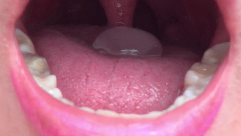 Angel eyes studio: Gırtlağımı ve karnımı buzla tazeliyorum!!