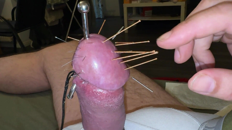 Qualzucht: Acupuncture - Orgasm!