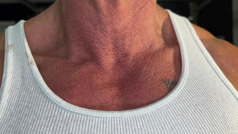 Kandylegsxxx: 绿帽男维生素过量：康提人消费后肌肉力量