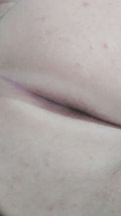 My Little White Ass