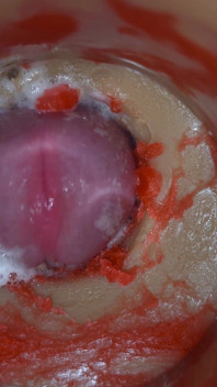 Insemination - Internal Camera Captures Deep Male Ejaculation