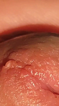 How to Widen a Glans Hole to the Extreme.