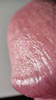 Penis Tropft