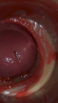 Camera Inside Deep Pussy Captures Huge Ejaculation of Sperm Asmr