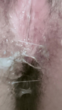 What Happened in My Ass