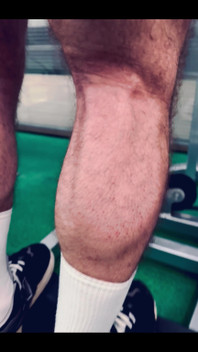 My Legs