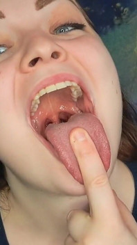 Alison's Mouth Inspection and Spit Play