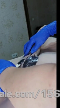 # 202 ceretta maschio con stimolazione elettrica