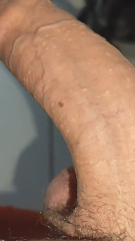 Big Uncircumcised Dick Opening Phimosis of the Glans.