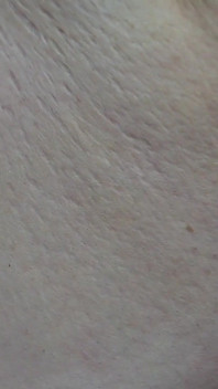 SSBBW up Close Body Exploration Stretch Marks