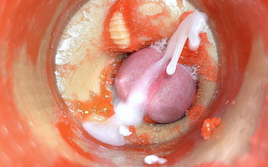 Creme sperm: Kamera dalam sudut pandangan pertama Cervix dubur, dicuckold kecil oleh 'pasangan...